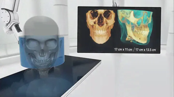 Tomograph CS 9000 3D